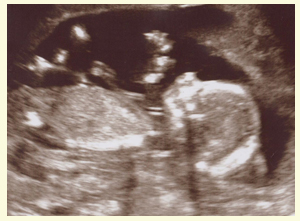 16 Недель Беременности Фото Плода На Узи