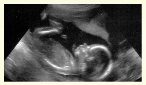 Беременность 19 Недель Развитие Плода Фото