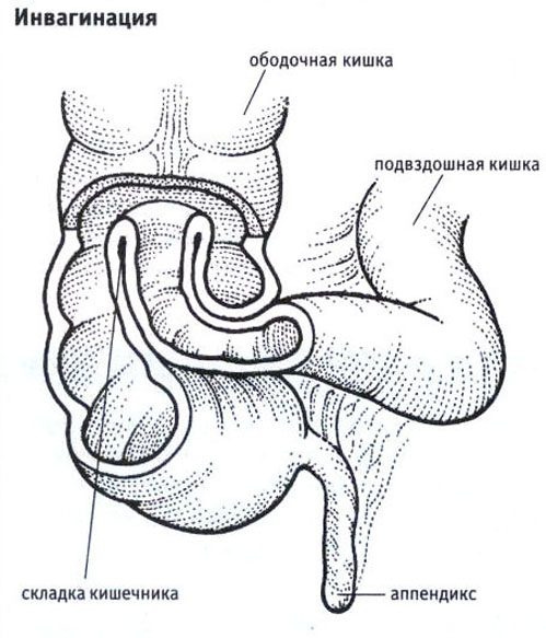 диеты при джвп