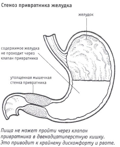 яблочная диета сок