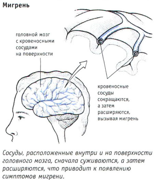 похудеть за 2 дня