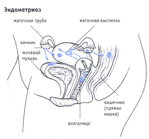 диета перед очищением кишечника при подготовке к операции